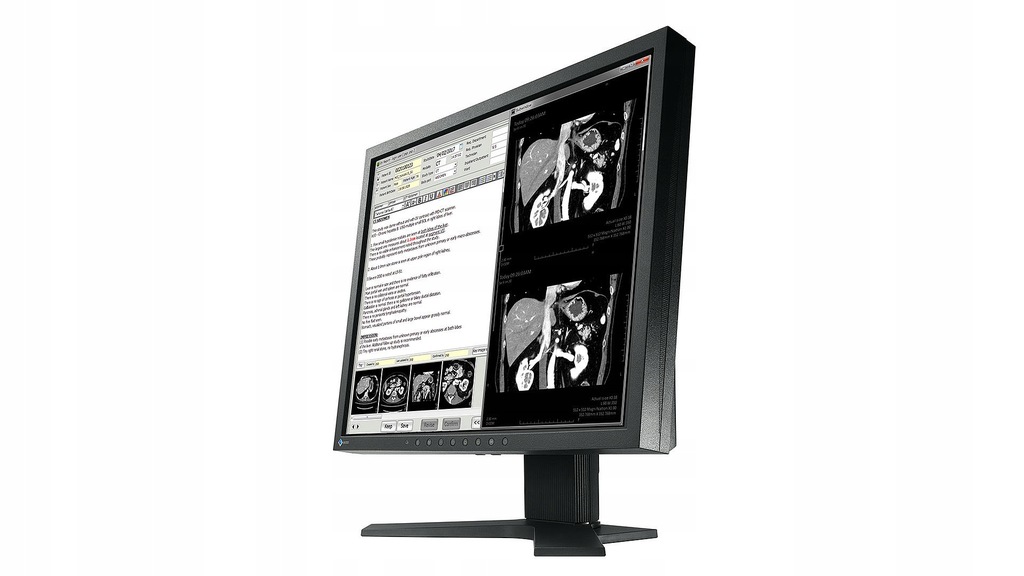 Monitor medyczny EIZO RadiForce MX194