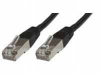 MicroConnect F/UTP CAT5e 2m Black PVC