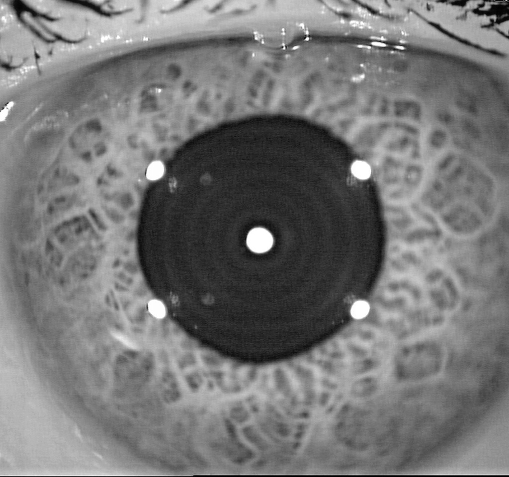 Nidek OPD-SCAN II - Aberrometr topograf rogówkowy
