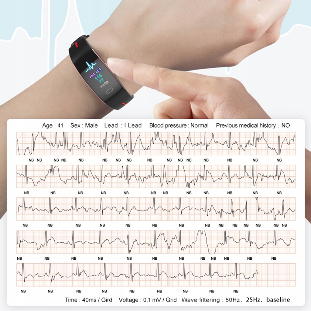 smartband ecg