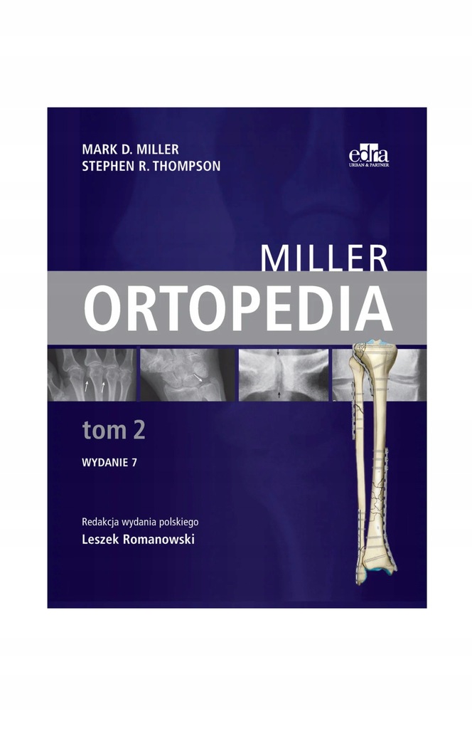Ortopedia Miller Tom 2 M.D. Miller, S.R. Thompson