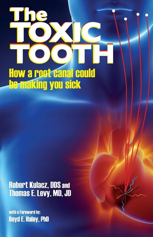 The Toxic Tooth DDS Robert Kulacz