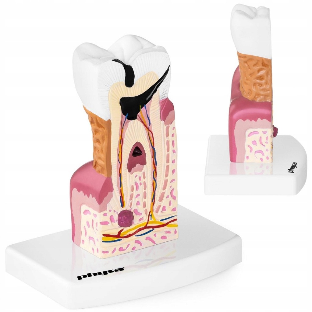 Model anatomiczny chorego zęba człowieka w skali 6