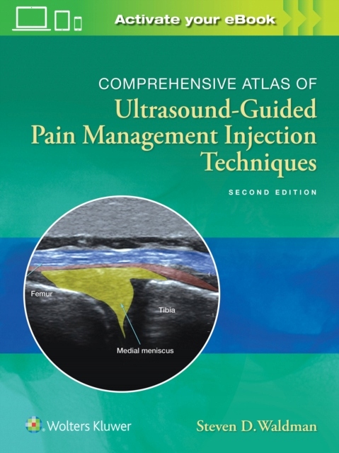 Comprehensive Atlas of Ultrasound-Guided Pain Management Injection Techniqu