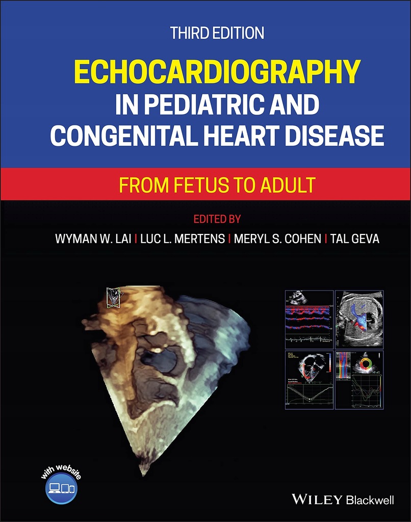 Wiley John + Sons Echocardiography in Pediatric