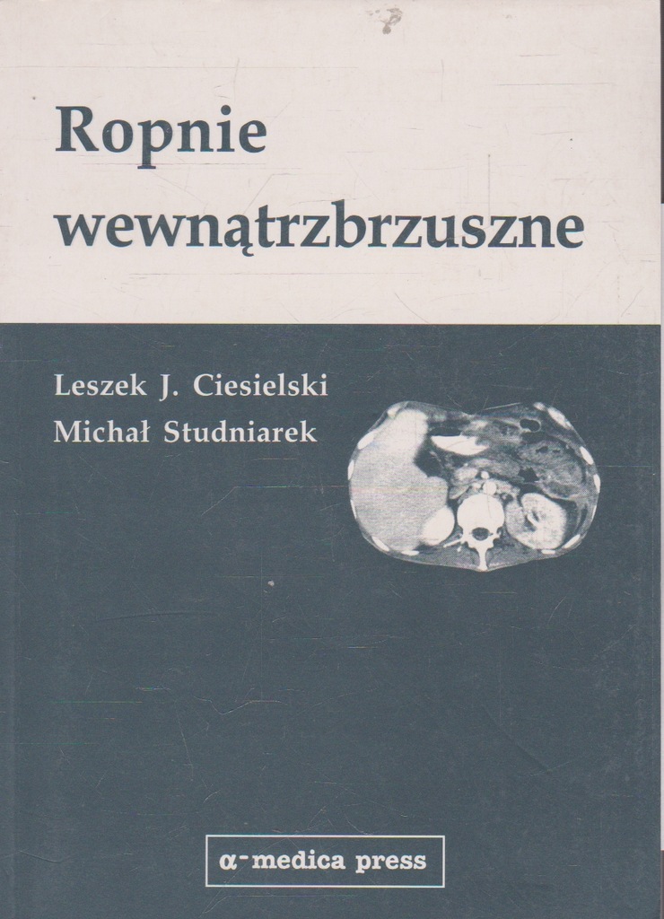 Ciesielski Studniarek ROPNIE WEWNĄTRZBRZUSZNE