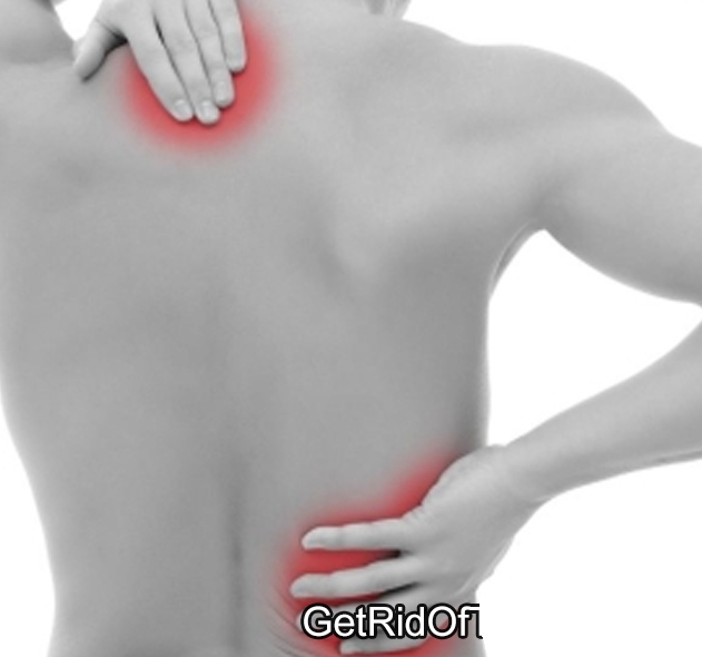 миозит форум