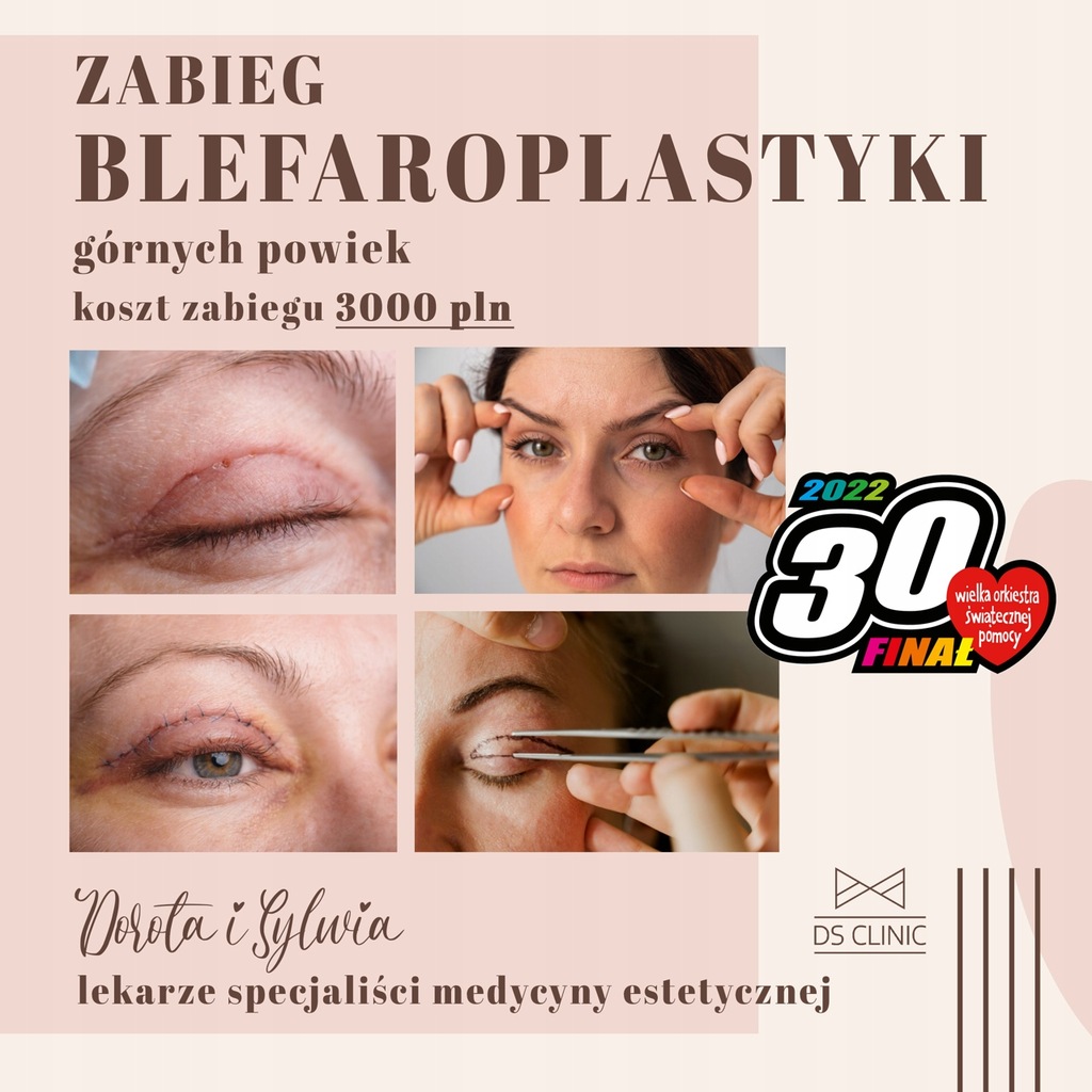 Zabieg korekty powiek górnych ( blepharoplastyka) 11780159137