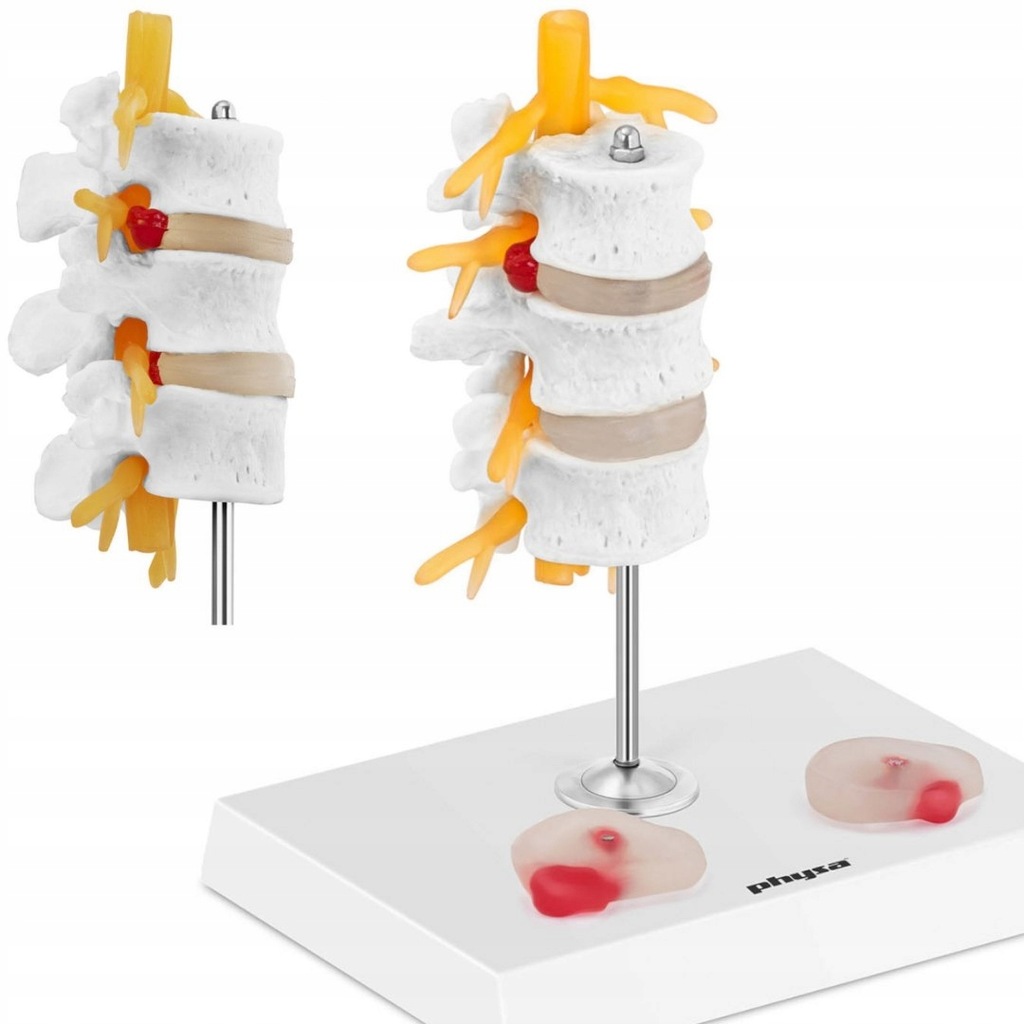 Model anatomiczny 3D odcinka lędźwiowego kręgosłup