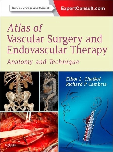 Atlas of Vascular Surgery and Endovascular Therapy ELLIOT L. CHAIKOF