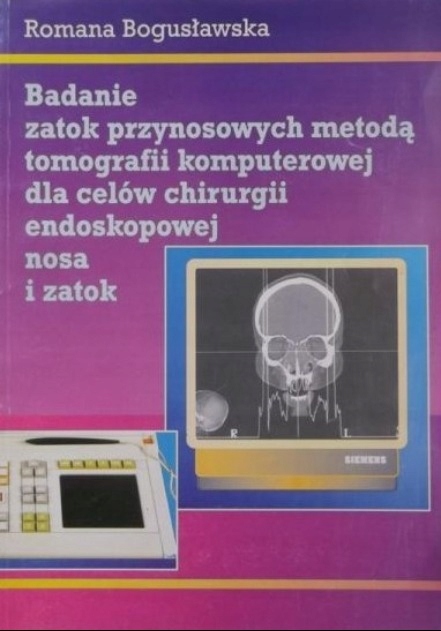 Badanie zatok przynosowych metodą tomografii