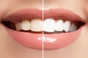 ОПАЛЕСЦЕНЦИЯ ОТБЕЛИВАЮЩАЯ ПАСТА __ TEETH WHITE США