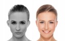 Otostick Эстетические корректоры для ушей БЕСПЛАТНАЯ ДОСТАВКА