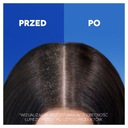 Head&Shoulders šampón proti vypadávaniu vlasov 400 ml Stav pokožky lupiny