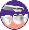 Dočasná náplň plomba zubná pasta DenTek pre drvený zub Kód výrobcu USP3610