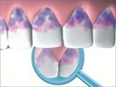Miradent Мира-2-тон жидкий краситель для зубных отложений