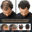 Šampón proti plešatosti Výživný pre rast vlasov Značka Oneofthose