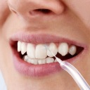 Ирригатор Sencor SOI 3312WH 5 уровней давления воды