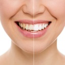Zubná pasta bez fluoridu ŠALVIA - RAKYTNÚK Veľkosť Produkt v plnej veľkosti