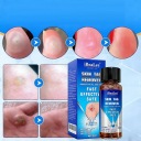 Від мозолів, натоптишів, бородавок 20 ml рідина 1pc — фото 10