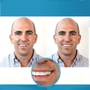 Набор Instant Smile TEETH REPLACEMENT для временной замены 4 оттенка