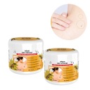 2 шт КРЕМ С ПЧЕЛИНЫМ ЯДОМ ДЛЯ УДАЛЕНИЯ бородавок и родинок, 30мл