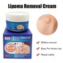 Krem Skutecznie Usuwający Tłuszczaki Nazwa Lipoma Removal Cream