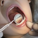 Ультразвуковой стоматологический скалер для зубов, 5 режимов