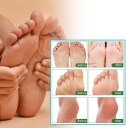 Дезодоранти для ніг CE 2 SZT 30ML — фото 6