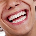 ApaCare Repair 30ml Gél na remineralizáciu zubov Veľkosť Produkt v plnej veľkosti