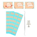 Встроенный корректор ногтей вросший консилер