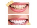 Zubná pasta Theramed Natur Weiss Prírodné bielenie zubov 5x100ml Značka Theramed