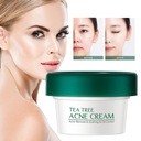 20 г крем для лица против прыщей для контроля жирности и гидратации