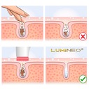LUMINEO kefa masážny prístroj na čistenie tváre každá pleť + špeciálny gél Počet trysiek v súprave 3