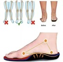 Ortopedická obuv pre ženy Korekčná obuv Značka inna