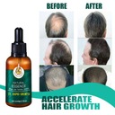 30 ml Ginger Growth Liquid proti vypadávaniu vlasov proti rastu Druh Iný