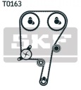DISTRIBUTION JEU COURROIE GALET VOLVO C30, C70 II, S40 II, S60 I, S80 I, S80photo 12