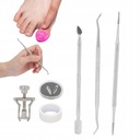 КОРРЕКЦИЯ ВРАСТНЫХ НОГТЕЙ НОСИНЫЕ