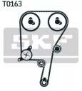 KIT DISTRIBUTION VERS VOLVO S40/60/80 2,0-2,5 00photo 11