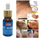 10 мл жидкость для лечения бородавок на теле, жидкость для удаления бородавок, анти