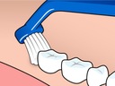 Ортодонтическая зубная щетка TePe Universal Care для чистки имплантатов