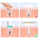 LUMINEO kefka masážny prístroj na umývanie tváre akné pupienky + bio gél Funkcie masáž čistenie exfoliácia