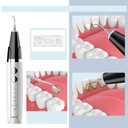 Ультразвуковой стоматологический скалер для зубов, 5 режимов