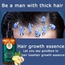 Zázvor éterický olej pre rast vlasov bylinné Typ vlasov pre všetky typy vlasov