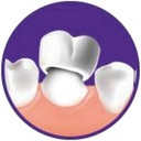 Dočasná náplň plomba zubná pasta DenTek pre drvený zub Stav balenia originálne