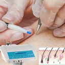 Профессиональный электроэпилятор 13 МГц.