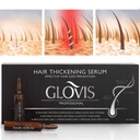 GLOVIS лосьон 12x10 Потеря, Утолщение, Рост