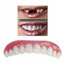 Виниры для улыбки фиксируются на зубах