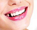 ToothFIX - Искусственные зубы, временные имплантаты, 10 шт.