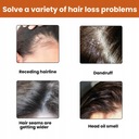 Anti Vypadávanie Vlasov Prírodný Šampón Zdravý Typ vlasov pre všetky typy vlasov